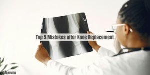 Top 5 Mistakes After Knee Replacement